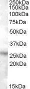 WB analysis of heart lysate with (B) and without (A) blocking with the immunising peptide using GTX88778 RASSF3 antibody, C-term. Dilution : 0.5microg/ml Loading : 35microg protein in RIPA buffer WB analysis of heart lysate with (B) and without (A) blocking with the immunising peptide using GTX88778 RASSF3 antibody, C-term. Dilution : 0.5microg/ml Loading : 35microg protein in RIPA buffer