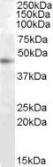WB analysis of HepG2 cell lysate using GTX88787 RASSF6 antibody, Internal. Dilution : 1microg/ml Loading : 35microg protein in RIPA buffer WB analysis of HepG2 cell lysate using GTX88787 RASSF6 antibody, Internal. Dilution : 1microg/ml Loading : 35microg protein in RIPA buffer
