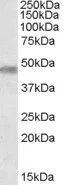 WB analysis of human brain (cerebellum) lysate using GTX88806 TOM1L1 antibody, Internal. Dilution : 0.3microg/ml Loading : 35microg protein in RIPA buffer WB analysis of human brain (cerebellum) lysate using GTX88806 TOM1L1 antibody, Internal. Dilution : 0.3microg/ml Loading : 35microg protein in RIPA buffer