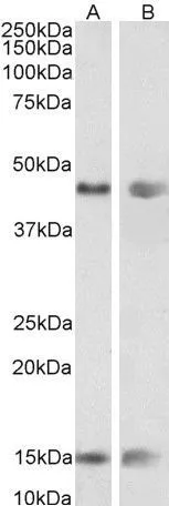 WB analysis of mouse (A) and rat (B) adrenal gland lysate using GTX88810 PNPLA3 antibody, Internal. Dilution : 0.01microg/ml Loading : 35microg protein in RIPA buffer WB analysis of mouse (A) and rat (B) adrenal gland lysate using GTX88810 PNPLA3 antibody, Internal. Dilution : 0.01microg/ml Loading : 35microg protein in RIPA buffer