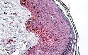 IHC-P analysis of human skin using GTX88810 PNPLA3 antibody, Internal. Antigen retrieval : citrate buffer pH 6 Dilution : 3.8microg/ml