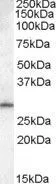 WB analysis of human testis lysate using GTX88812 MTHFD2L antibody, N-term. Dilution : 0.1microg/ml Loading : 35microg protein in RIPA buffer WB analysis of human testis lysate using GTX88812 MTHFD2L antibody, N-term. Dilution : 0.1microg/ml Loading : 35microg protein in RIPA buffer