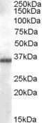 WB analysis of A549 cell lysate using GTX88827 AKR1B10 antibody, C-term. Dilution : 0.03microg/ml Loading : 35microg protein in RIPA buffer WB analysis of A549 cell lysate using GTX88827 AKR1B10 antibody, C-term. Dilution : 0.03microg/ml Loading : 35microg protein in RIPA buffer