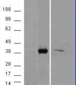 WB analysis of HEK293 overexpressing AKR1B10 with C-terminal tag (DYKDDDDK) using GTX88827 AKR1B10 antibody, C-term. Left panel : tag antibody(mock transfection in first lanes) Right panel : primary antibody(mock transfection in last lanes)