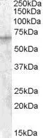 WB analysis of HepG2 cell lysate using GTX88840 IGF2BP2 antibody, C-term. Dilution : 1microg/ml Loading : 35microg protein in RIPA buffer WB analysis of HepG2 cell lysate using GTX88840 IGF2BP2 antibody, C-term. Dilution : 1microg/ml Loading : 35microg protein in RIPA buffer