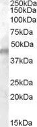 WB analysis of human muscle lysate using GTX88845 Kir6.2 antibody, Internal (near the N-term). Dilution : 0.01microg/ml Loading : 35microg protein in RIPA buffer WB analysis of human muscle lysate using GTX88845 Kir6.2 antibody, Internal (near the N-term). Dilution : 0.01microg/ml Loading : 35microg protein in RIPA buffer