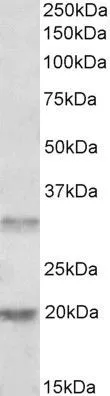 WB analysis of human tonsil lysate using GTX88848 ASRGL1 antibody, Internal. Dilution : 0.5microg/ml Loading : 35microg protein in RIPA buffer