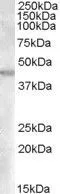 WB analysis of human kidney lysate using GTX88853 GOT2 (aa 295 to 306) antibody, Internal. Dilution : 0.03microg/ml Loading : 35microg protein in RIPA buffer WB analysis of human kidney lysate using GTX88853 GOT2 (aa 295 to 306) antibody, Internal. Dilution : 0.03microg/ml Loading : 35microg protein in RIPA buffer