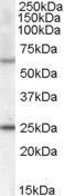 WB analysis of mouse heart lysate using GTX88855 COL4A3BP (aa662-672) antibody, Internal. Dilution : 0.5microg/ml Loading : 35microg protein in RIPA buffer WB analysis of mouse heart lysate using GTX88855 COL4A3BP (aa662-672) antibody, Internal. Dilution : 0.5microg/ml Loading : 35microg protein in RIPA buffer