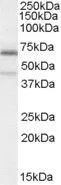 WB analysis of A431 cell lysate using GTX88860 C14orf169 / NO66 antibody, Internal. Dilution : 0.3microg/ml Loading : 35microg protein in RIPA buffer WB analysis of A431 cell lysate using GTX88860 C14orf169 / NO66 antibody, Internal. Dilution : 0.3microg/ml Loading : 35microg protein in RIPA buffer