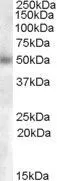 WB analysis of human lymph node lysate using GTX88861 GCNT3 (aa 273 to 284) antibody, Internal. Dilution : 0.3microg/ml Loading : 35microg protein in RIPA buffer WB analysis of human lymph node lysate using GTX88861 GCNT3 (aa 273 to 284) antibody, Internal. Dilution : 0.3microg/ml Loading : 35microg protein in RIPA buffer