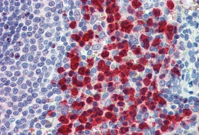 IHC-P analysis of human spleen using GTX88883 CADM4 antibody, C-term. Antigen retrieval : citrate buffer pH 6 Dilution : 2.5microg/ml