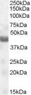 WB analysis of human muscle lysate using GTX88896 TUSC4 antibody, Internal. Dilution : 0.1microg/ml Loading : 35microg protein in RIPA buffer WB analysis of human muscle lysate using GTX88896 TUSC4 antibody, Internal. Dilution : 0.1microg/ml Loading : 35microg protein in RIPA buffer