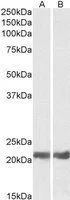 WB analysis of mouse (A) and rat (B) eye lysates using GTX88907 alpha B Crystallin antibody, Internal. Dilution : 0.05microg/ml Loading : 35microg protein in RIPA buffer