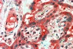 IHC-P analysis of human placenta using GTX88911 FAIM1 antibody, Internal. Antigen retrieval : citrate buffer pH 6 Dilution : 2.5microg/ml