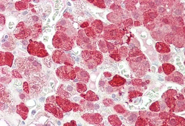 IHC-P analysis of human adrenal gland using GTX88915 EPB41L4B antibody, Internal. Antigen retrieval : citrate buffer pH 6 Dilution : 3.75microg/ml IHC-P analysis of human adrenal gland using GTX88915 EPB41L4B antibody, Internal. Antigen retrieval : citrate buffer pH 6 Dilution : 3.75microg/ml