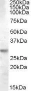 WB analysis of human brain (hippocampus) lysate using GTX88929 14-3-3 theta antibody, Internal. Dilution : 0.03microg/ml Loading : 35microg protein in RIPA buffer WB analysis of human brain (hippocampus) lysate using GTX88929 14-3-3 theta antibody, Internal. Dilution : 0.03microg/ml Loading : 35microg protein in RIPA buffer