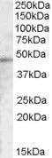 WB analysis of A431 cell lysate using GTX88931 TMPRSS3 antibody, Internal. Dilution : 0.1microg/ml Loading : 35microg protein in RIPA buffer WB analysis of A431 cell lysate using GTX88931 TMPRSS3 antibody, Internal. Dilution : 0.1microg/ml Loading : 35microg protein in RIPA buffer