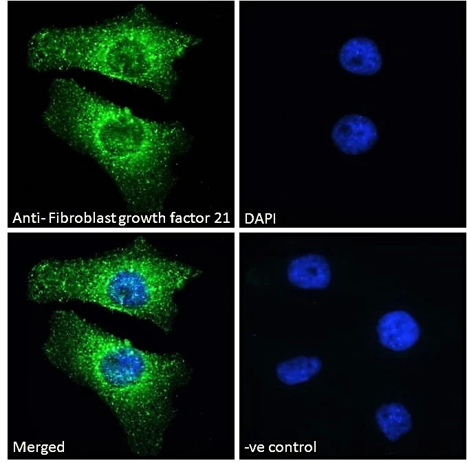ICC/IF analysis of paraformaldehyde fixed HeLa cells using GTX88943 FGF21 antibody, Internal. Green : Primary antibody Blue : DAPI Negative control: Unimmunized goat IgG Dilution : 10microg/ml