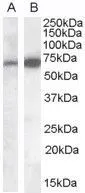 WB analysis of human brain (cerebellum) lysate using GTX88956 CADM4 antibody, Internal. Lane A : GTX88956 (0.1microg/ml) Lane B : GTX88883 (0.05microg/ml) Loading : 35microg protein in RIPA buffer WB analysis of human brain (cerebellum) lysate using GTX88956 CADM4 antibody, Internal. Lane A : GTX88956 (0.1microg/ml) Lane B : GTX88883 (0.05microg/ml) Loading : 35microg protein in RIPA buffer