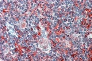 IHC-P analysis of human thymus using GTX88956 CADM4 antibody, Internal. Antigen retrieval : citrate buffer pH 6 Dilution : 2.5microg/ml