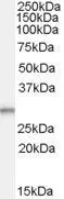 WB analysis of human breast cancer lysate using GTX88975 TPD52L2 antibody, C-term. Dilution : 0.1microg/ml Loading : 35microg protein in RIPA buffer WB analysis of human breast cancer lysate using GTX88975 TPD52L2 antibody, C-term. Dilution : 0.1microg/ml Loading : 35microg protein in RIPA buffer