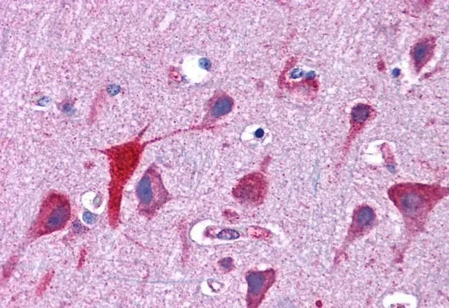 IHC-P analysis of human cortex using GTX88975 TPD52L2 antibody, C-term. Antigen retrieval : citrate buffer pH 6 Dilution : 3.75microg/ml