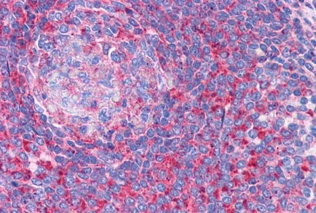 IHC-P analysis of human spleen using GTX88975 TPD52L2 antibody, C-term. Antigen retrieval : citrate buffer pH 6 Dilution : 3.75microg/ml