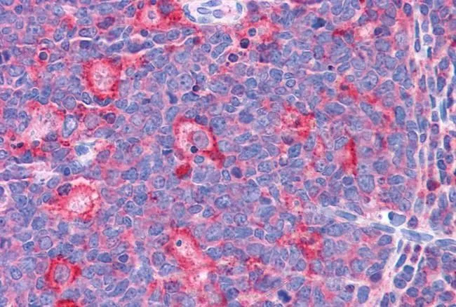 IHC-P analysis of human tonsil using GTX88975 TPD52L2 antibody, C-term. Antigen retrieval : citrate buffer pH 6 Dilution : 3.75microg/ml