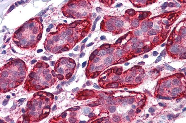 IHC-P analysis of human breast using GTX88977 Thyroid Hormone Receptor alpha antibody, Internal. Antigen retrieval : citrate buffer pH 6 Dilution : 3.75microg/ml