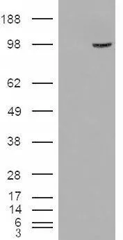 WB analysis of HEK293 overexpressing SMEK1 (mock transfection in first lane) using GTX88983 SMEK1 antibody, Internal.