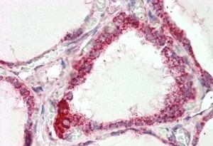 IHC-P analysis of human thyroid Gland using GTX88987 COX4I1 antibody, C-term. Antigen retrieval : citrate buffer pH 6 Dilution : 2.5microg/ml