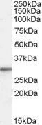 WB analysis of HepG2 cell lysate using GTX88990 RPL8 antibody, Internal. Dilution : 0.01microg/ml Loading : 35microg protein in RIPA buffer WB analysis of HepG2 cell lysate using GTX88990 RPL8 antibody, Internal. Dilution : 0.01microg/ml Loading : 35microg protein in RIPA buffer