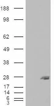WB analysis of HEK293 overexpressing SAR1B (mock transfection in first lane) using GTX88997 SAR1B antibody, Internal.