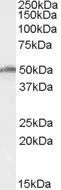 WB analysis of K562 cell lysate using GTX89006 DBP5 / DDX19 antibody, Internal. Dilution : 0.5microg/ml Loading : 35microg protein in RIPA buffer WB analysis of K562 cell lysate using GTX89006 DBP5 / DDX19 antibody, Internal. Dilution : 0.5microg/ml Loading : 35microg protein in RIPA buffer