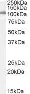 WB analysis of K562 cell lysate using GTX89007 IDE antibody, Internal. Dilution : 0.1microg/ml Loading : 35microg protein in RIPA buffer WB analysis of K562 cell lysate using GTX89007 IDE antibody, Internal. Dilution : 0.1microg/ml Loading : 35microg protein in RIPA buffer