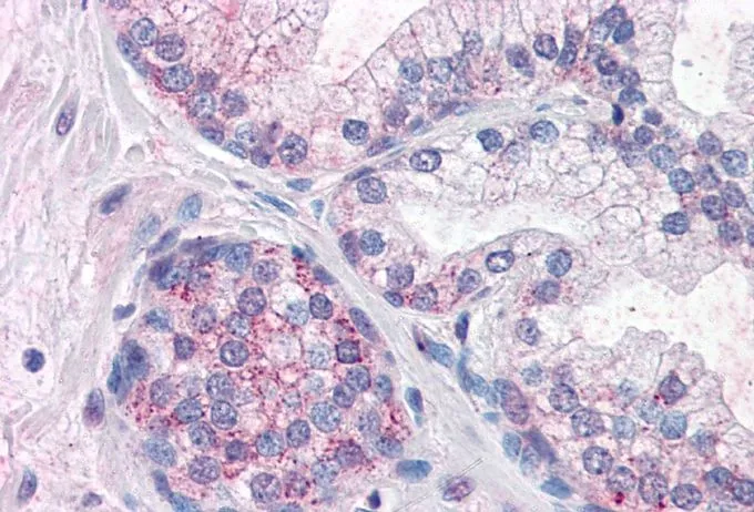 IHC-P analysis of human prostate using GTX89018 PDE11A antibody, Internal. Antigen retrieval : citrate buffer pH 6 Dilution : 10microg/ml