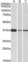 WB analysis of human liver (A),skin (B) and tonsil (C) lysate using GTX89024 IL12B / IL12 p40 antibody,Internal. Dilution : 0.3ug/ml Loading : 35ug protein in RIPA buffer