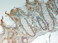 IHC-P analysis of human colon using GTX89024 IL12B / IL12 p40 antibody, Internal. Antigen retrieval : citrate buffer pH 9 Dilution : 4microg/ml