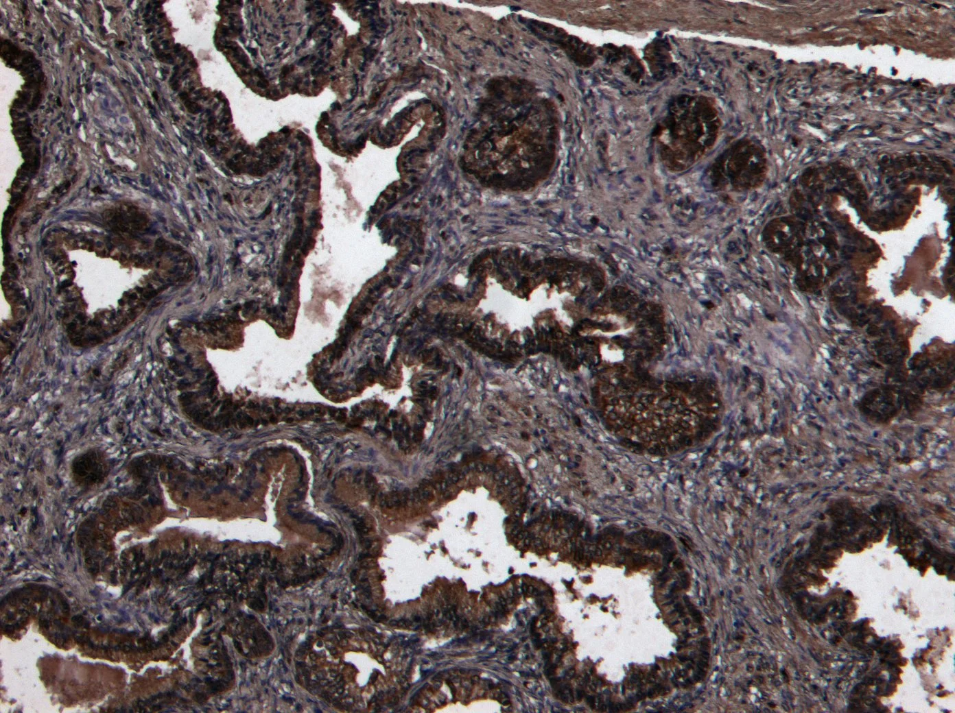 IHC-P analysis of human prostate tissue using GTX89027 CD26 antibody, Internal. Antigen retrieval : Heat induced antigen retrieval with citrate buffer pH 6 Dilution : 8microg/ml