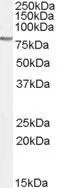 WB analysis of K562 cell lysate using GTX89031 GAB2 antibody, Internal. Dilution : 0.5microg/ml Loading : 35microg protein in RIPA buffer