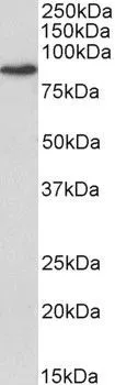 WB analysis of A549 lysate using GTX89037 Transglutaminase 2 antibody, Internal. Dilution : 0.1microg/ml Loading : 35microg protein in RIPA buffer