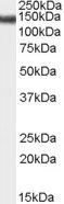WB analysis of HeLa cell lysate using GTX89044 SA2 antibody, Internal. Dilution : 0.01microg/ml Loading : 35microg protein in RIPA buffer WB analysis of HeLa cell lysate using GTX89044 SA2 antibody, Internal. Dilution : 0.01microg/ml Loading : 35microg protein in RIPA buffer