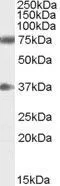 WB analysis of human brain (cerebellum) lysate using GTX89047 NRG3 antibody, C-term. Dilution : 0.3microg/ml Loading : 35microg protein in RIPA buffer WB analysis of human brain (cerebellum) lysate using GTX89047 NRG3 antibody, C-term. Dilution : 0.3microg/ml Loading : 35microg protein in RIPA buffer