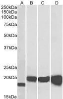 WB analysis of NIH-3T3 (A), HEK293 (B), HepG2 (C) and MCF7 (D) lysates using GTX89049 SOD1 antibody, Internal. Dilution : 0.01microg/ml Loading : 35microg protein in RIPA buffer WB analysis of NIH-3T3 (A), HEK293 (B), HepG2 (C) and MCF7 (D) lysates using GTX89049 SOD1 antibody, Internal. Dilution : 0.01microg/ml Loading : 35microg protein in RIPA buffer