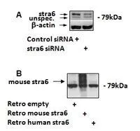 WB analysis of 3T3-L1 lysates using GTX89070 STRA6 (mouse, rat) antibody, C-term. Dilution : 1.7microg/ml Loading : 35microg protein in RIPA buffer WB analysis of 3T3-L1 lysates using GTX89070 STRA6 (mouse, rat) antibody, C-term. Dilution : 1.7microg/ml Loading : 35microg protein in RIPA buffer