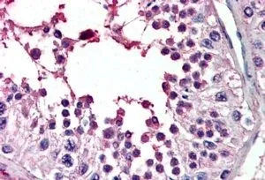 IHC-P analysis of human testis using GTX89083 PIAS2 antibody, Internal. Antigen retrieval : citrate buffer pH 6 Dilution : 3.8microg/ml IHC-P analysis of human testis using GTX89083 PIAS2 antibody, Internal. Antigen retrieval : citrate buffer pH 6 Dilution : 3.8microg/ml