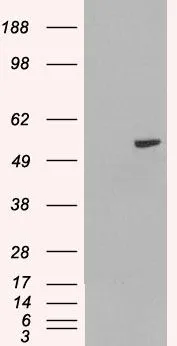 WB analysis of HEK293 overexpressing PAX8A (mock transfection in first lane) using GTX89084 PAX8 antibody, Internal. WB analysis of HEK293 overexpressing PAX8A (mock transfection in first lane) using GTX89084 PAX8 antibody, Internal.
