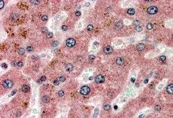 IHC-P analysis of human liver using GTX89085 Apolipoprotein CI antibody, C-term. Antigen retrieval : citrate buffer pH 6 Dilution : 3.8microg/ml IHC-P analysis of human liver using GTX89085 Apolipoprotein CI antibody, C-term. Antigen retrieval : citrate buffer pH 6 Dilution : 3.8microg/ml
