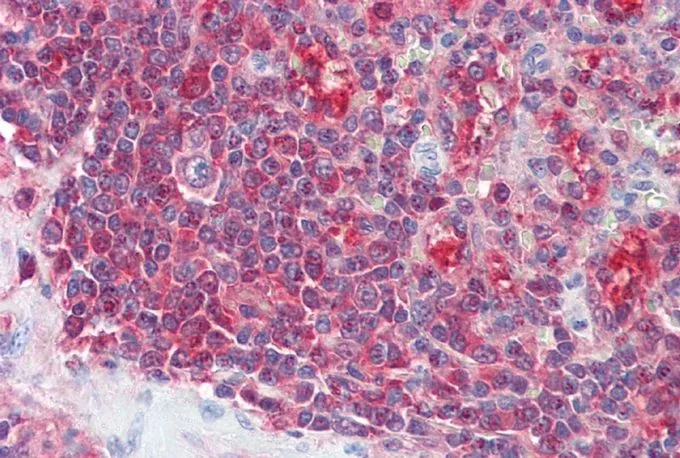 IHC-P analysis of human spleen using GTX89096 PSME2 antibody, C-term. Antigen retrieval : citrate buffer pH 6 Dilution : 5microg/ml